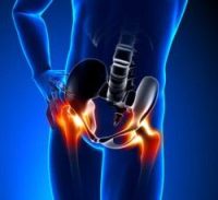 Hip Pain Treatment London