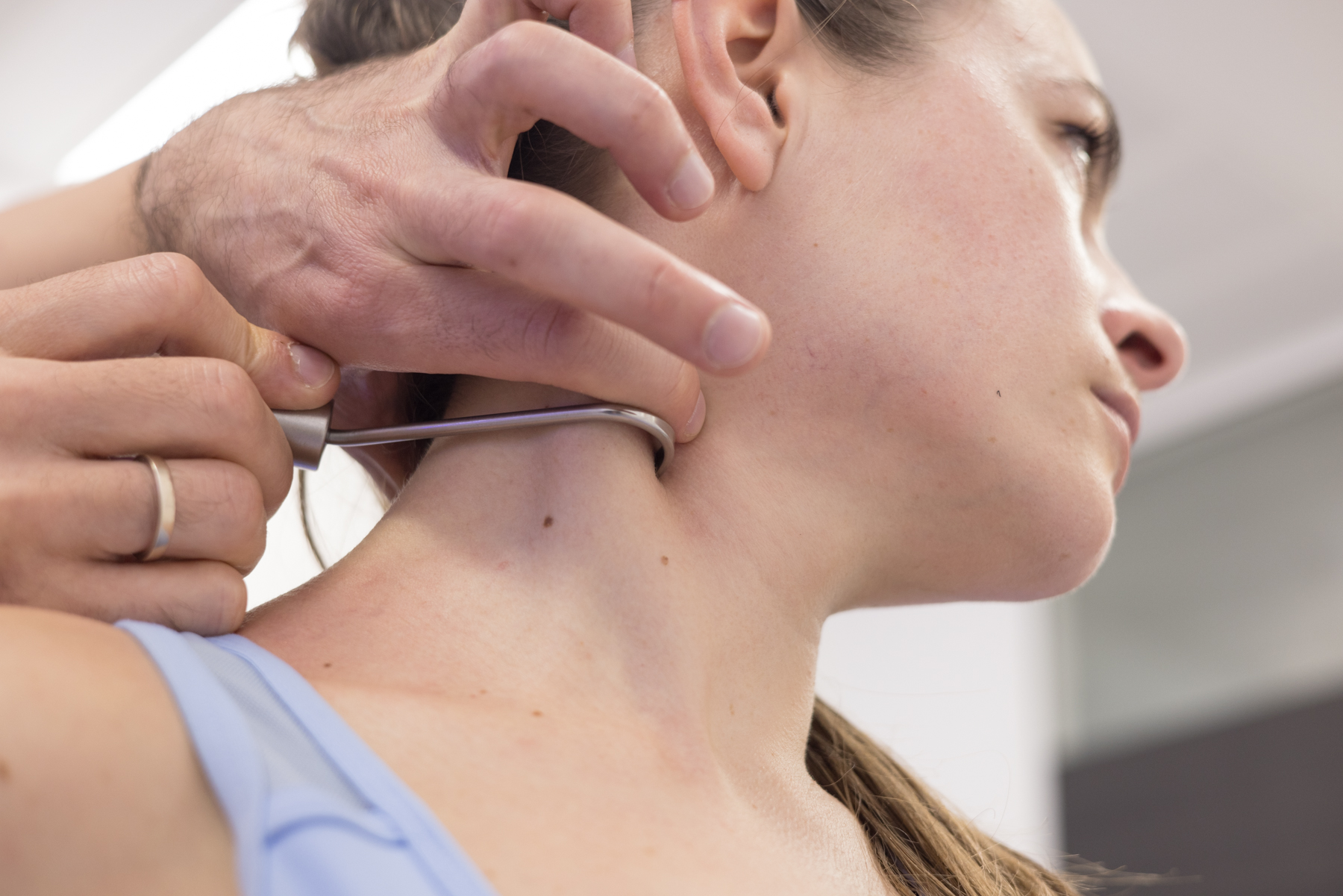 Diacutaneous Fibrolysis on Sternocleidomastoid Muscle